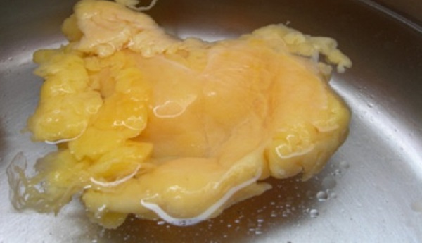 Những lợi ích của mỡ vịt đối với sức khỏe